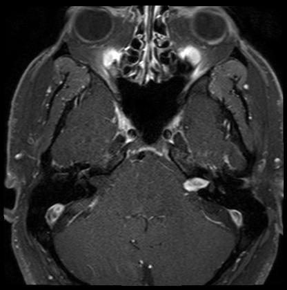 Facial Mri 5